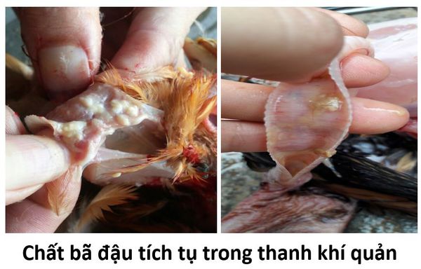 Triệu chứng của bệnh ORT